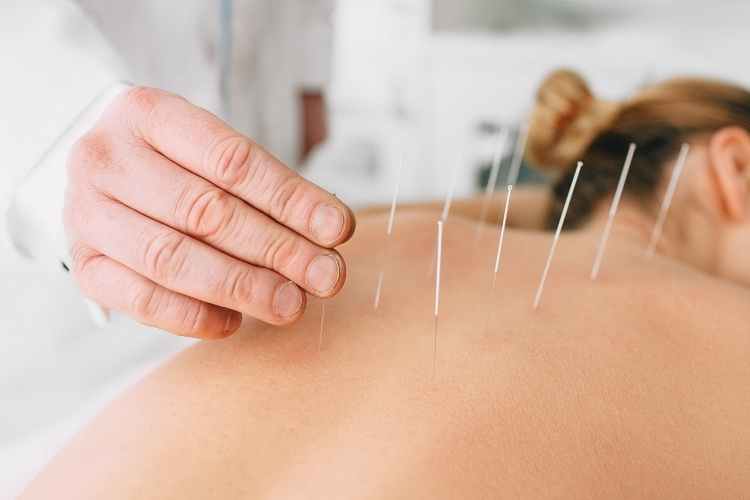Acupuncture: What Is It, How It Works, Treatments